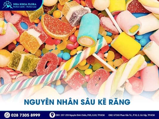 sâu kẽ răng - ảnh 3