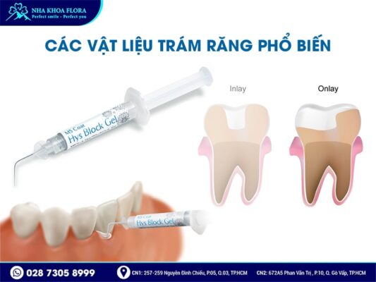Trám răng bao nhiêu tiền - ảnh 4