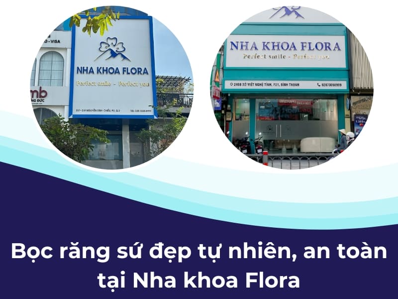 bảng màu răng sứ