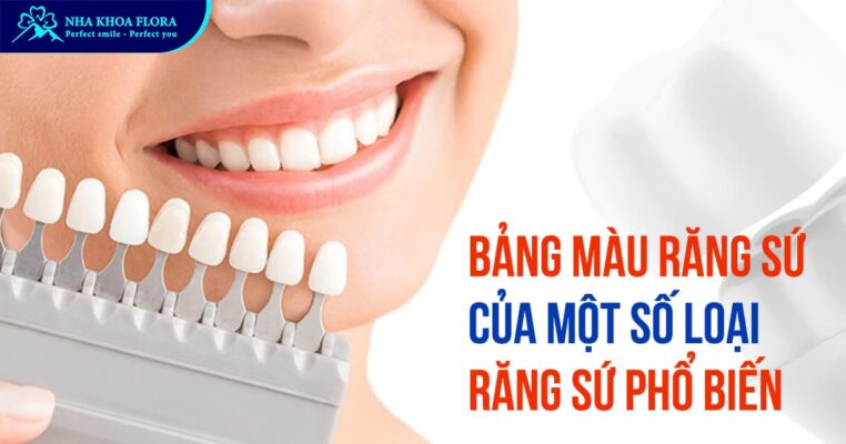 bảng màu răng sứ