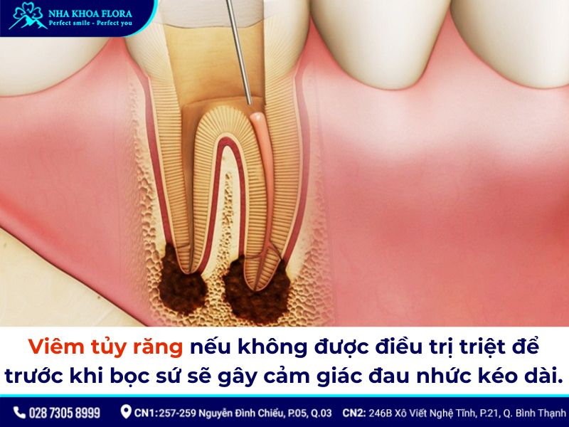 bọc răng sứ bị nhức phải làm sao