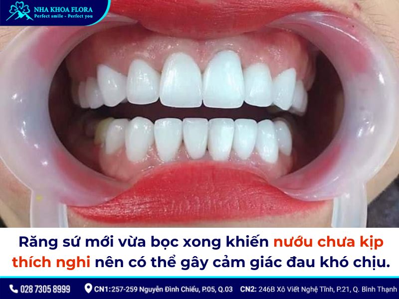 bọc răng sứ bị nhức phải làm sao