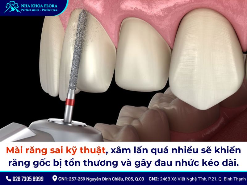 bọc răng sứ bị nhức phải làm sao