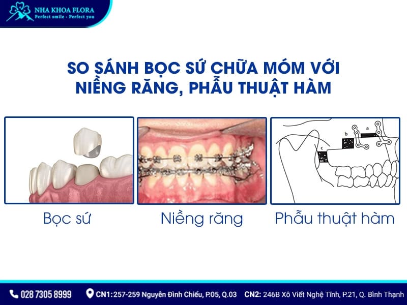 bọc răng sứ có hết móm không
