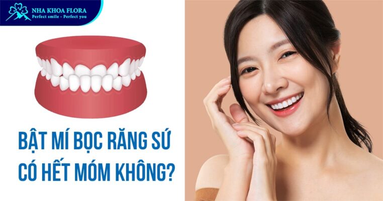 bọc răng sứ có hết móm không