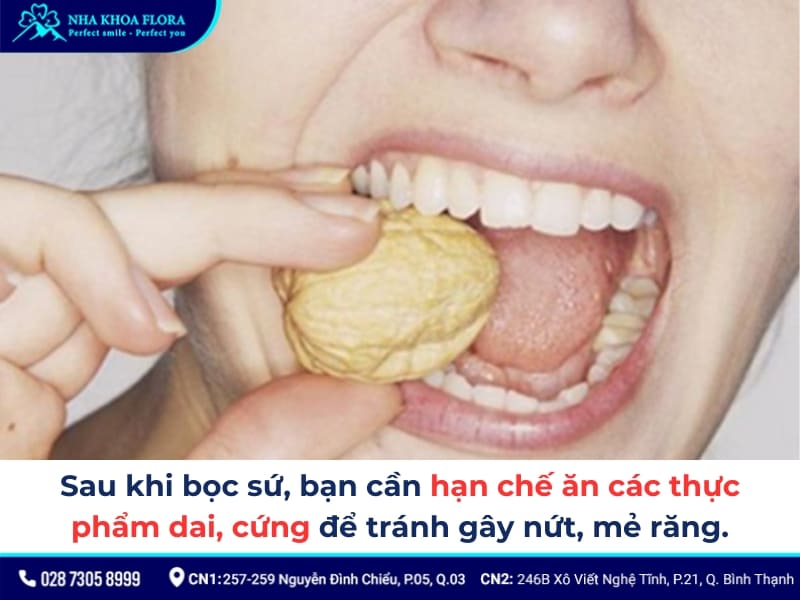 bọc răng sứ có hết móm không