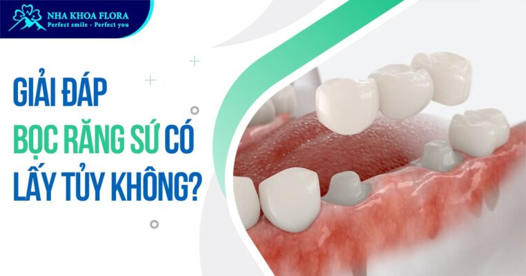 bọc răng sứ có lấy tủy không