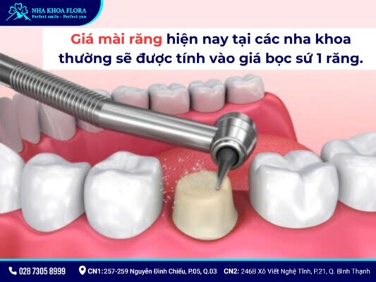 mài răng bọc sứ - ảnh 5