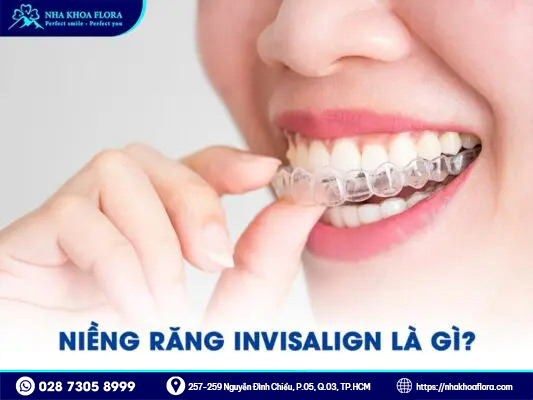 DỊCH VỤ NIỀNG RĂNG TRONG SUỐT INVISALIGN 1