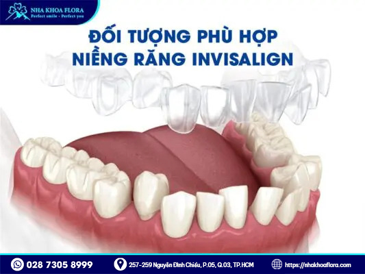 DỊCH VỤ NIỀNG RĂNG TRONG SUỐT INVISALIGN 2