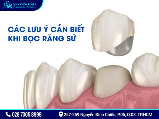 Bị nha chu có bọc răng sứ được không? - ảnh 3