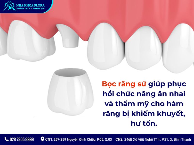 bọc răng sứ có phải nhổ răng không