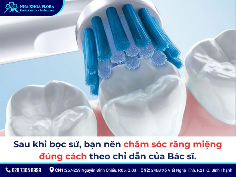 bọc răng sứ khểnh