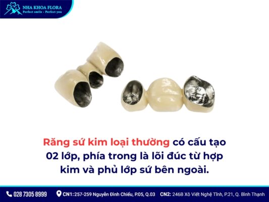 Bọc răng sứ kim loại được bao lâu? - ảnh 1