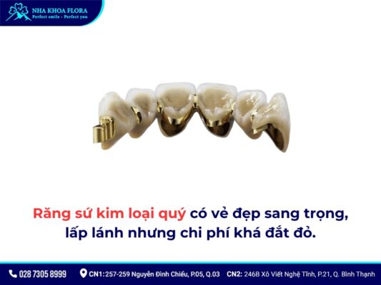 Bọc răng sứ kim loại được bao lâu? - ảnh 3
