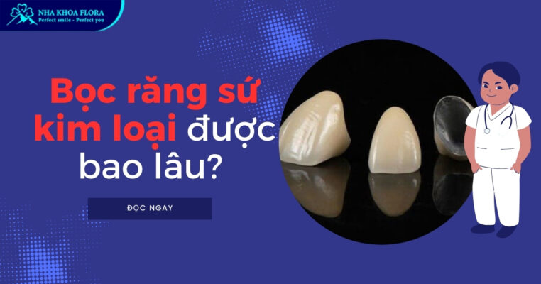 Bọc răng sứ kim loại được bao lâu?