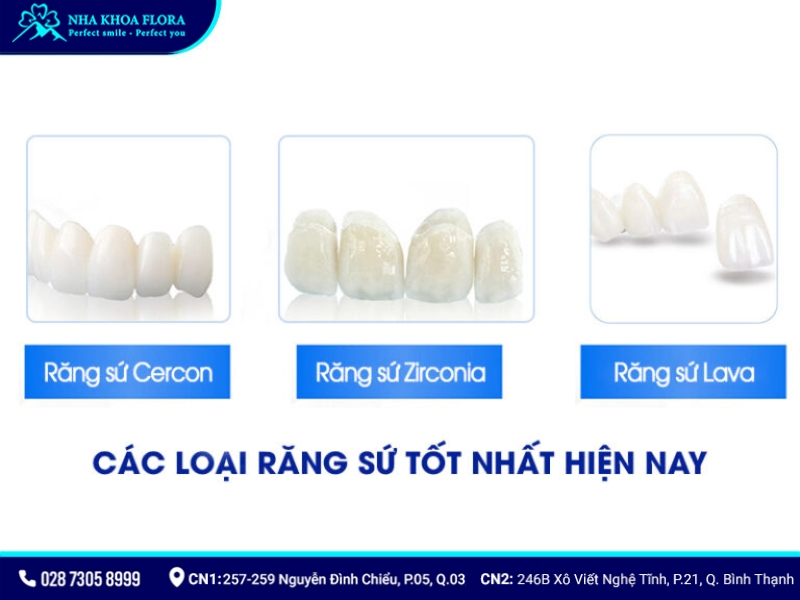 các loại răng sứ