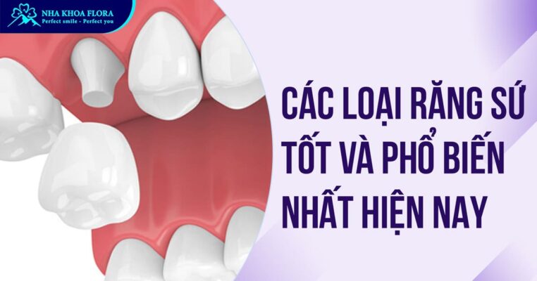 các loại răng sứ
