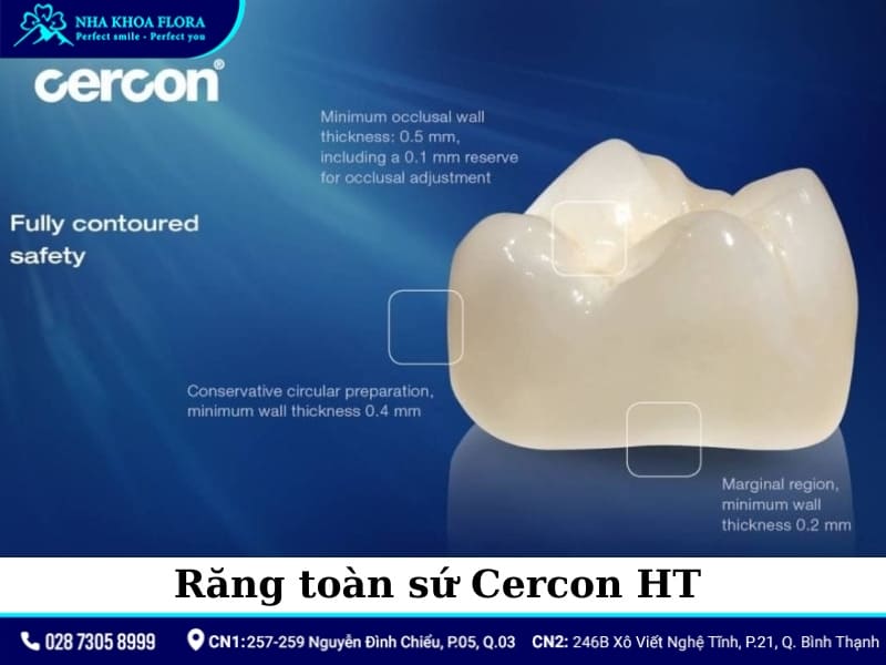 các loại răng sứ