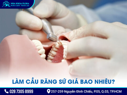 Cầu răng sứ - ảnh 4 Cầu răng sứ - ảnh 4