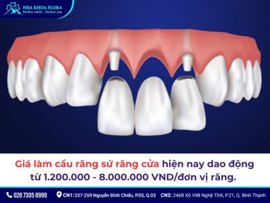 Cầu răng sứ răng cửa - ảnh 3 Cầu răng sứ răng cửa - ảnh 3
