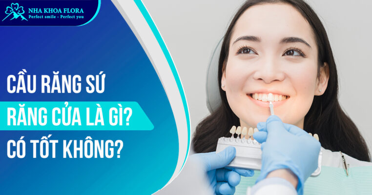 Cầu răng sứ răng cửa