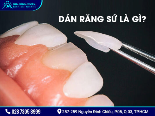 Dán răng sứ có tốt không? - ảnh 1