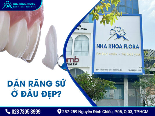 Dán răng sứ có tốt không? - ảnh 4