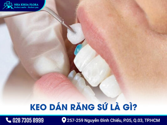 Keo dán răng sứ - ảnh 1