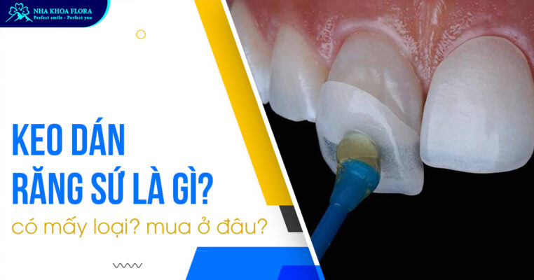 Keo dán răng sứ