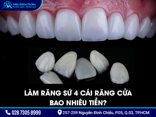 Làm răng sứ 4 răng cửa - ảnh 3