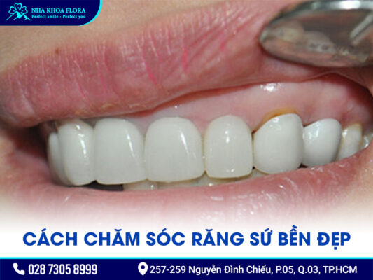 làm răng sứ bị thâm nướu - ảnh 4