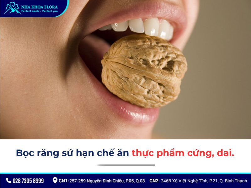 nhược điểm của việc bọc răng sứ
