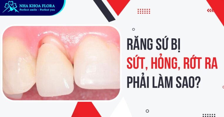 răng sứ bị sứt