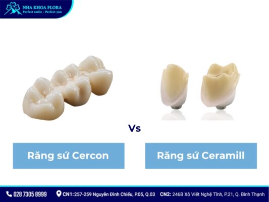 Răng sứ Ceramill - ảnh 7