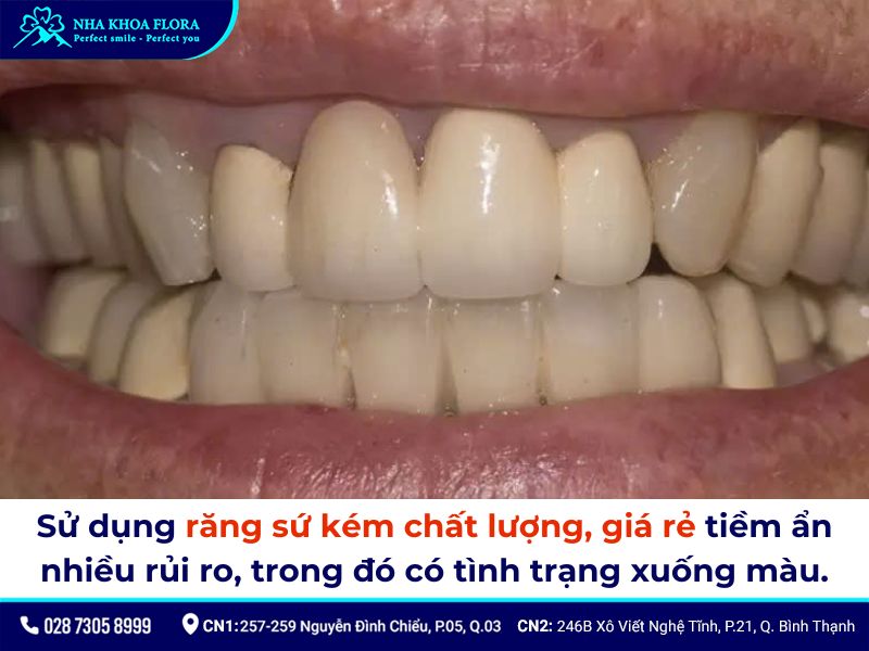 răng sứ có bị ố vàng không