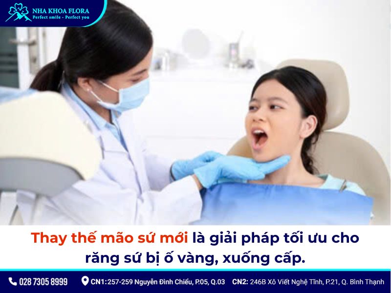 răng sứ có bị ố vàng không