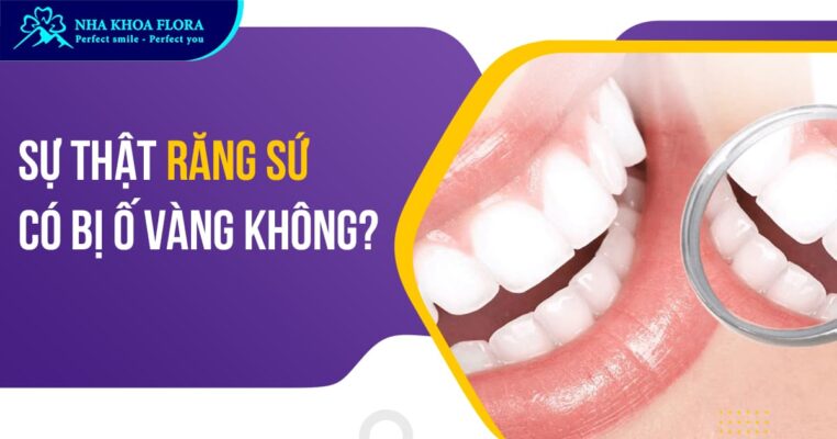 răng sứ có bị ố vàng không