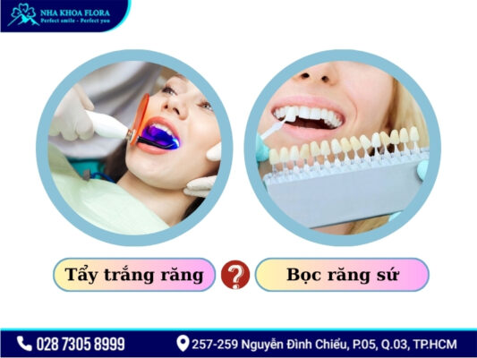Răng sứ có tẩy trắng được không - ảnh 5