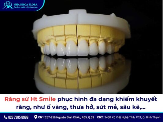 răng sứ Ht Smile - ảnh 2
