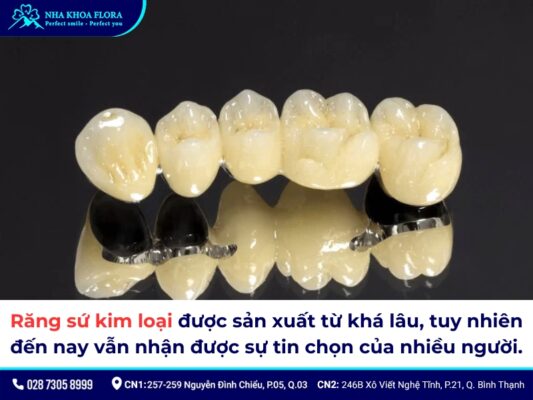 Răng sứ kim loại có tốt không? Chi phí làm hết bao nhiêu? 1