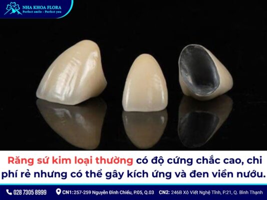 Răng sứ kim loại có tốt không? Chi phí làm hết bao nhiêu? 2