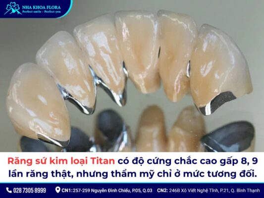 Răng sứ kim loại có tốt không? Chi phí làm hết bao nhiêu? 3