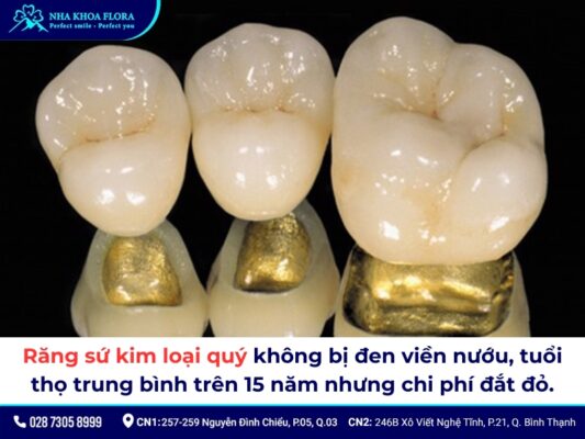 Răng sứ kim loại có tốt không? Chi phí làm hết bao nhiêu? 4