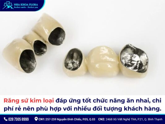 Răng sứ kim loại có tốt không? Chi phí làm hết bao nhiêu? 5