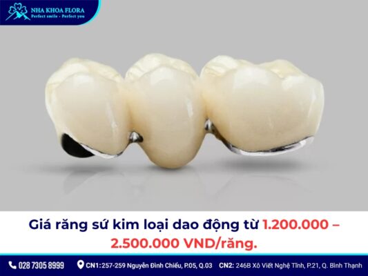 Răng sứ kim loại có tốt không? Chi phí làm hết bao nhiêu? 6