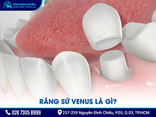 Răng sứ Venus và Zirconia - ảnh 1