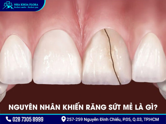 Răng sứt - ảnh 1