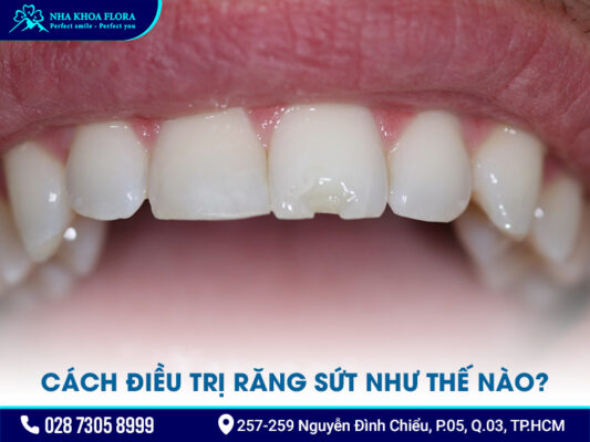 Răng sứt - ảnh 2