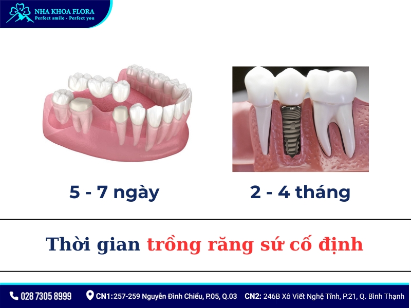 trồng răng sứ cố định